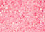 Cylin Seed Beads 11/0 - 25g Bag - Glow in the Dark - Rose AB